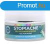 STOP!ACNE gl pattansos brre 50ml