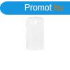 Honor X6a tltsz vkony szilikon tok (2mm)