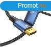 Vention DisplayPort/M (8K,HD, szvet, alu), 1,5m, kbel