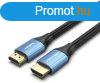 Vention HDMI/M -> HDMI/M (4K, HD, Alu, kk), 1,5m, kbel