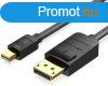 Vention mini Displayport -> Displayport, (fekete), 1,5m, 