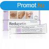 Redupetin dermatolgiai specilis kencs 20 ml