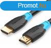 Vention HDMI, (fekete), 1m, kbel