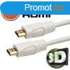 HDMI kbel 5 m 3D (20424)