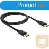 BLACKBIRD Kbel Displayport 1.2 male/male sszekt 4K 60Hz,