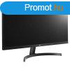 LG 29" 29WP500-B IPS LED