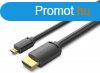 Vention micro HDMI/M -> HDMI/M (4K,HD,fekete), 3m, kbel