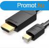 Vention miniDisplayport to HDMI cable 2m Black