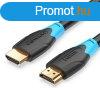 Vention HDMI ( aktv, fekete), 1,5m, kbel